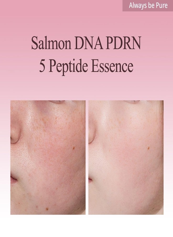 كن دائما نقيا Always Be Pure Marine Origin Mela-PDRN Peptide Essence, Skin Renew Serum with Salmon DNA, Niacinamide for Gloning Skin, Korean Skincare, 150ml/5.07 floz. - Image 4